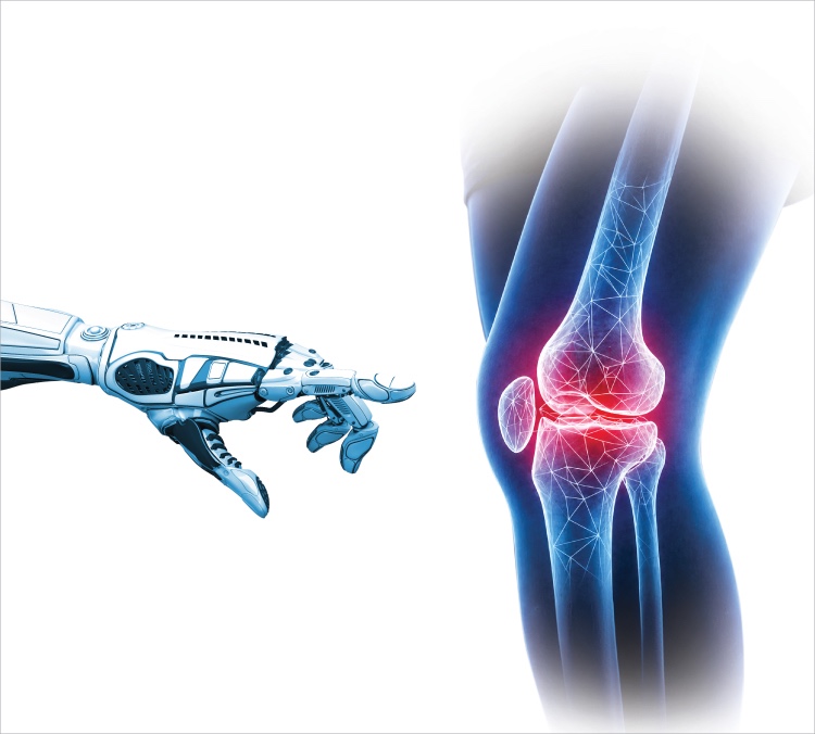 Robotic Assisted Joint Replacement