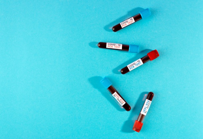  Different Types of Neurological Blood Tests